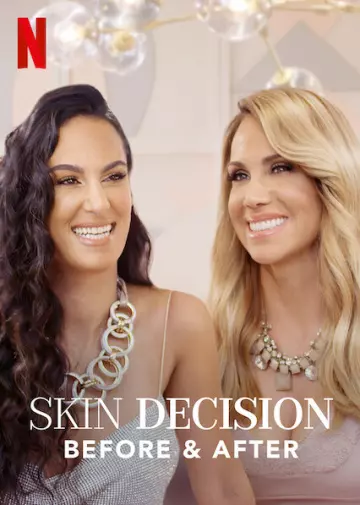 Skin Decision: Before and After - Saison 1